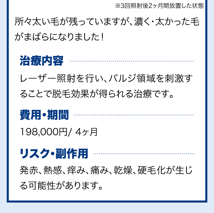 気になる脱毛効果