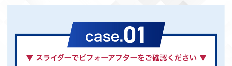症例