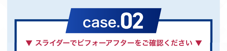 症例