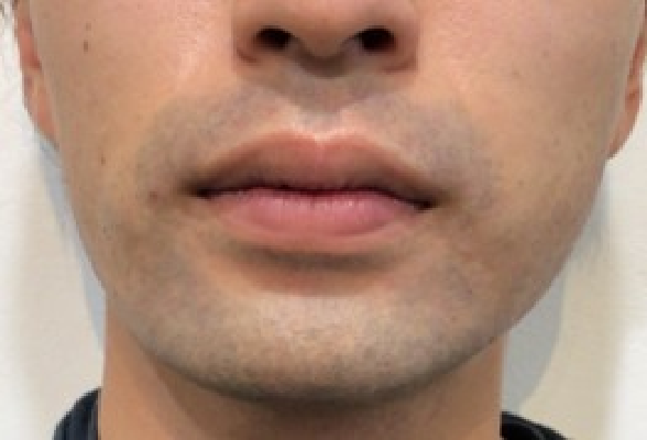 After