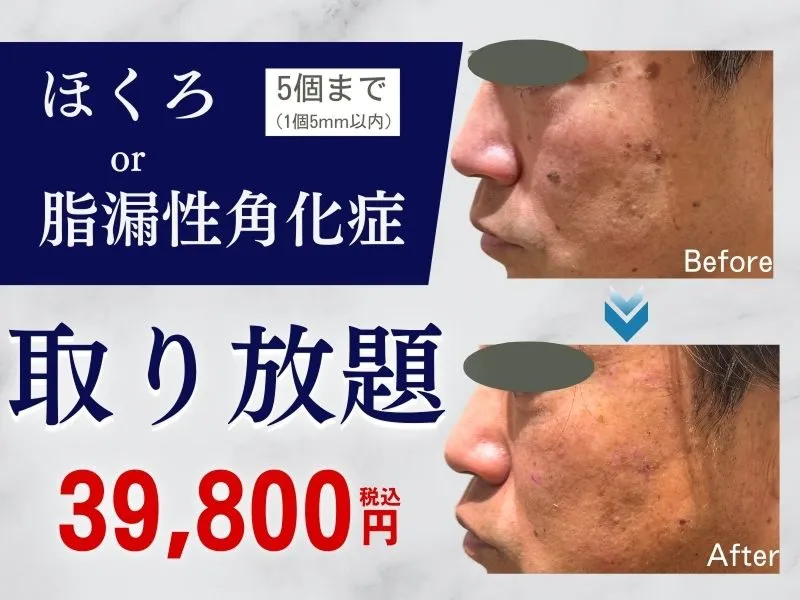 今月のキャンペーン