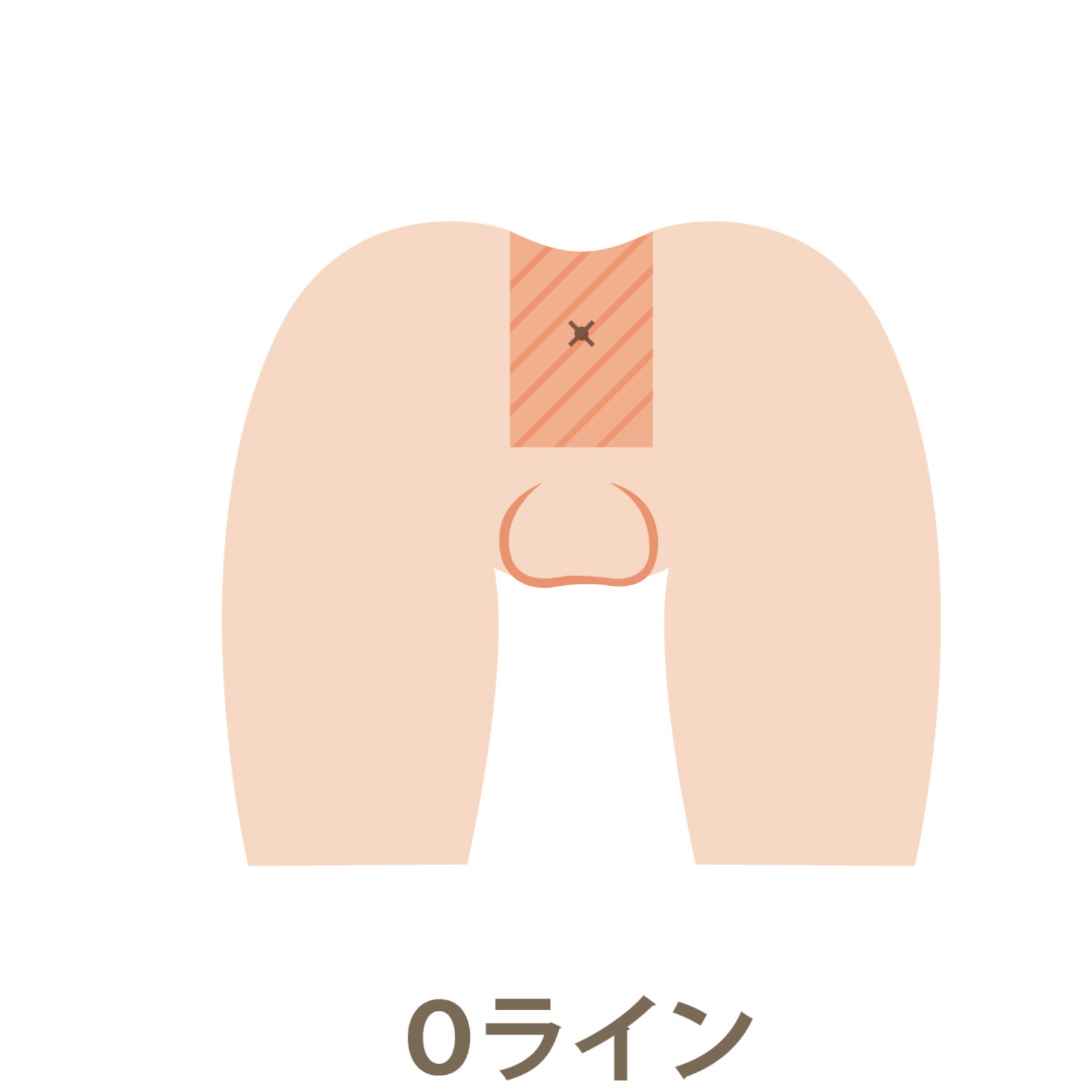 Oライン