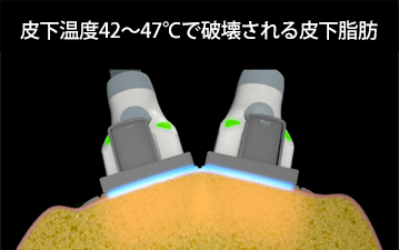 スカルプシュア（太田院限定）